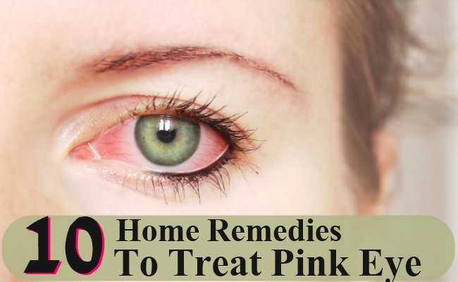 10 Home Remedies To Treat Pink Eye Morpheme Remedies India