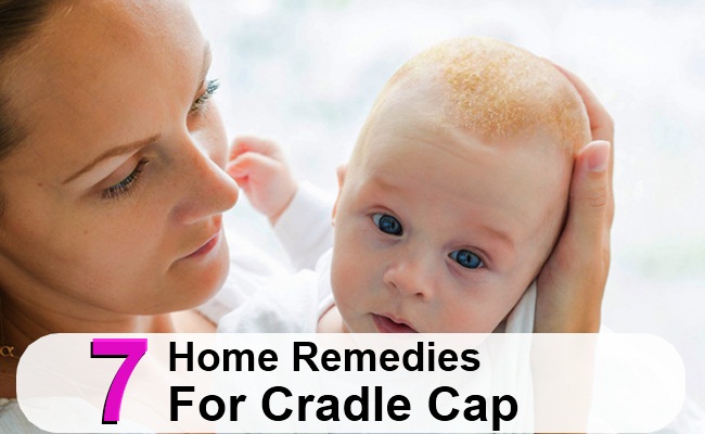 7 Home Remedies For Cradle Cap Morpheme Remedies India